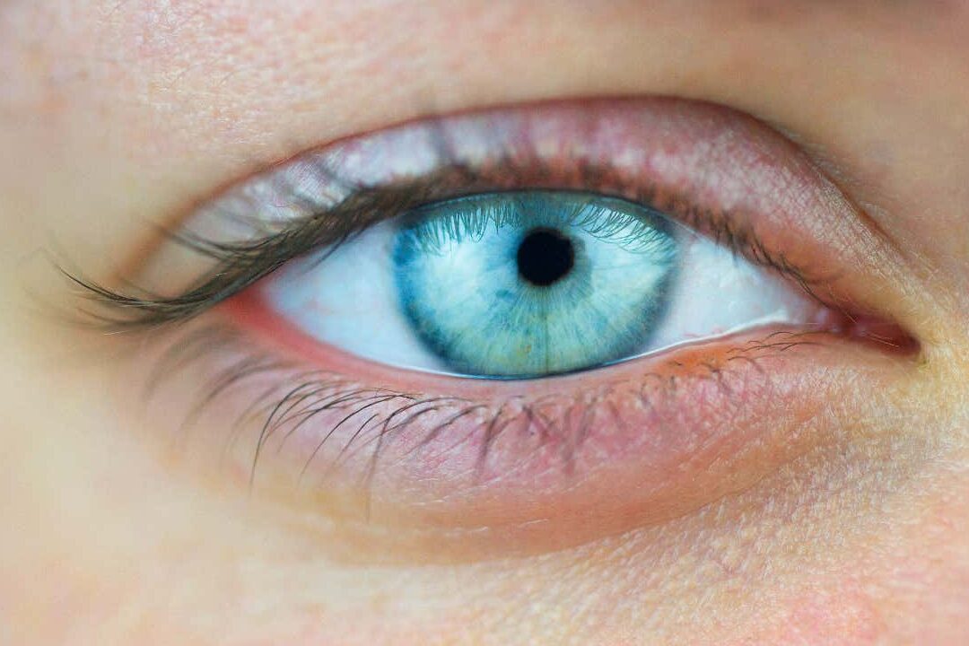 Discovering the Evolution of Lenses A Brief History